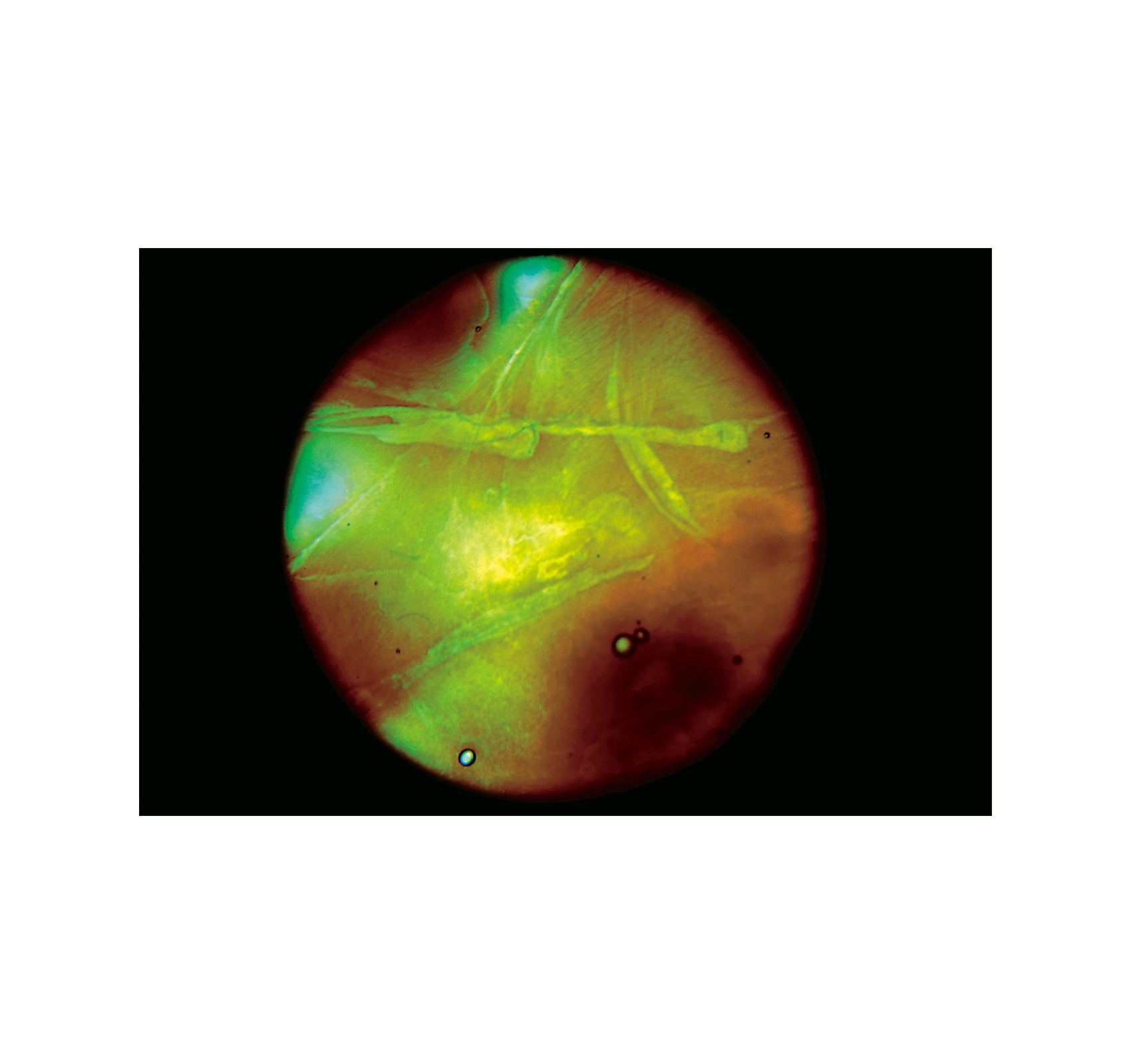 MY BLOODY HAND by Momo Okabe